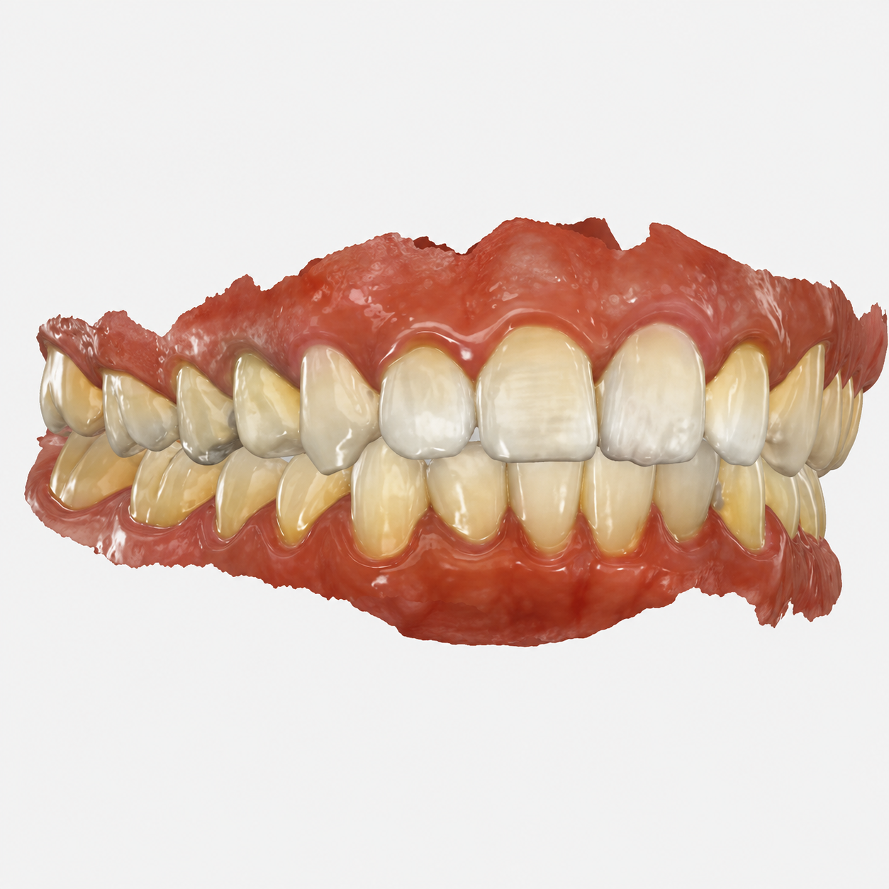 Escaneamento Intraoral 3D Adequa
